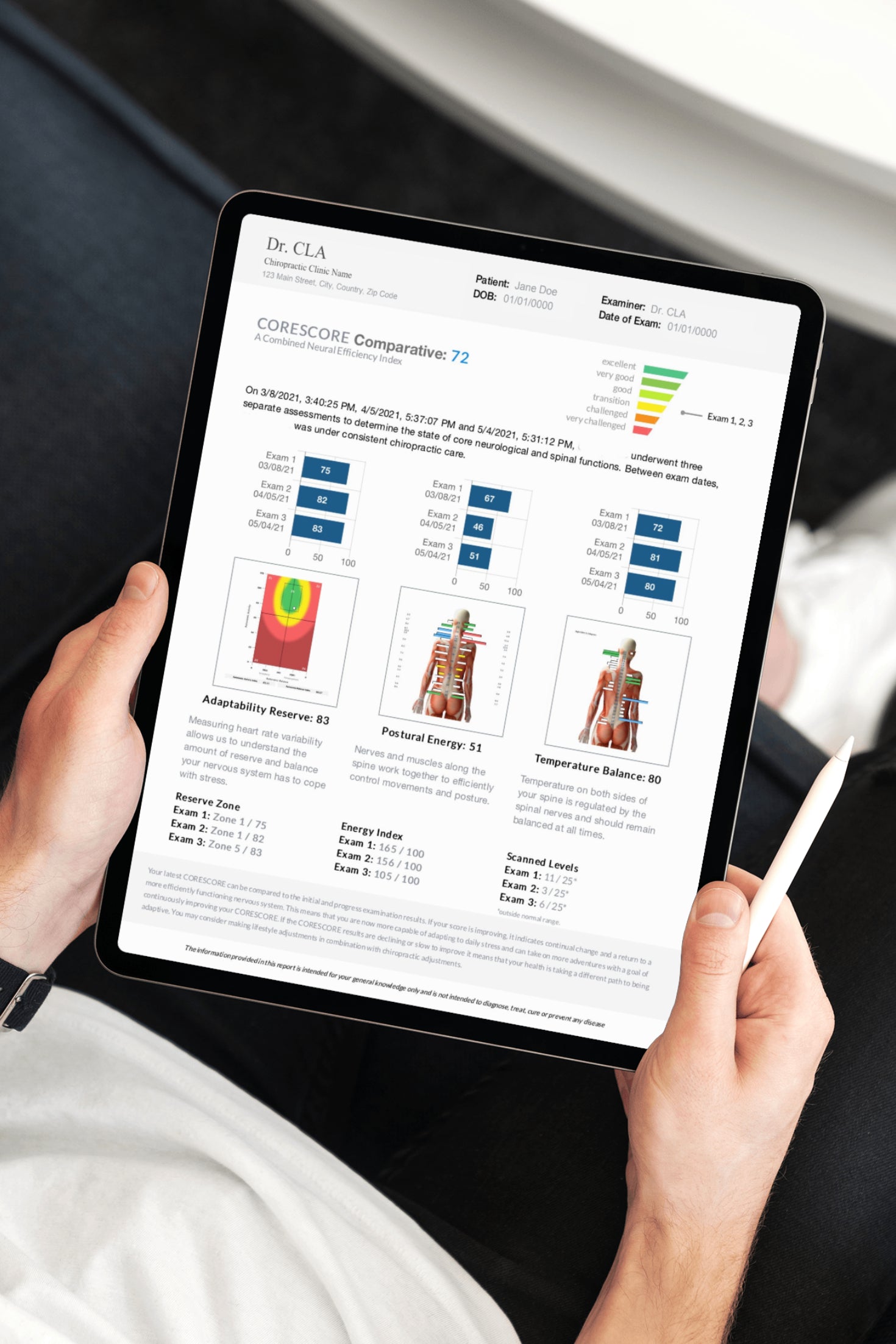 Products – INSiGHT CLA